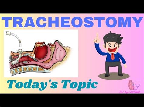 Tracheostomy Tracheostomy Surgery Tracheostomy General Surgery