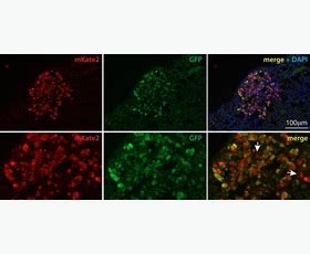 Anti-GFP antibody (ab13970) | Abcam