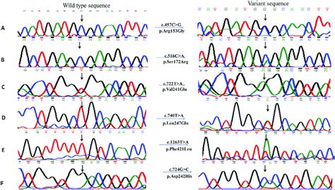 Chromatograms Of Novel Disease Causing Single Nucleotide Substitutions Download Scientific