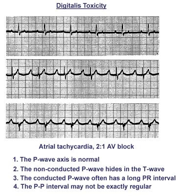 ECG Learning Center An Introduction To Clinical Electrocardiography