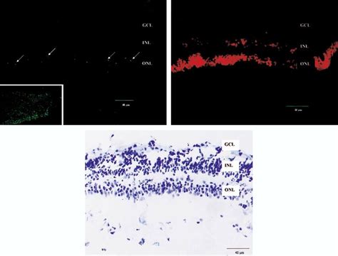 Photomicrographs Of Retinal Tissue Photomicrographs Of 4 M Frozen