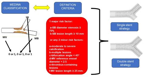 Basics Of Coronary Bifurcation And Treatment In Brief Encyclopedia MDPI