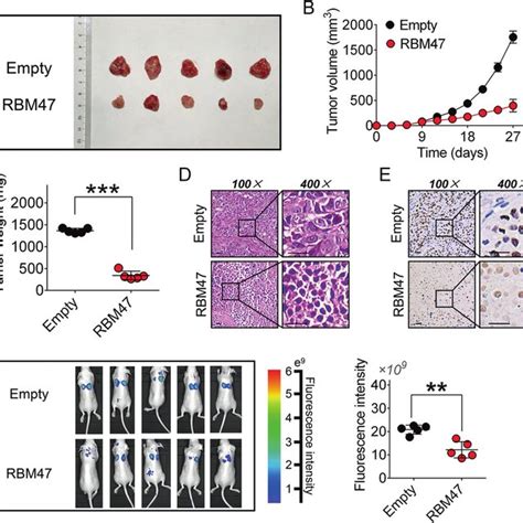 RBM47 Inhibits Tumor Growth And Metastasis In Vivo A Representative