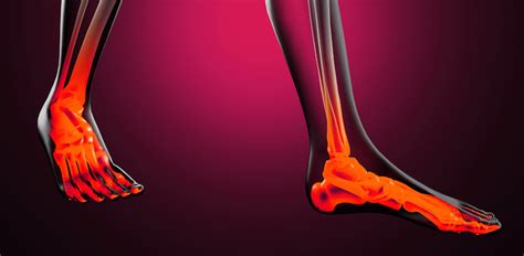 What Causes Heel Pain After Running (And How To Fix It) | Arizona Pain