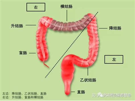 一文读懂结直肠癌的化疗、靶向和免疫治疗 知乎