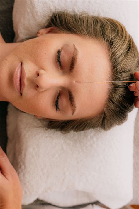 Facial Cosmetic Acupuncture Cosmetics Wellness Clinic Mae