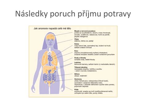 PPT PORUCHY PŘÍJMU POTRAVY PowerPoint Presentation free download