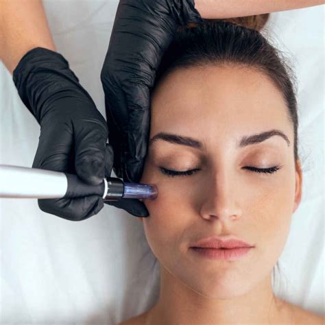 Aurora Estética Mesoterapia Con Dermapen