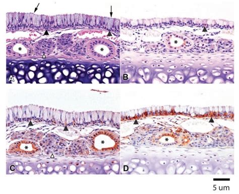 Nasal Turbinate Histology