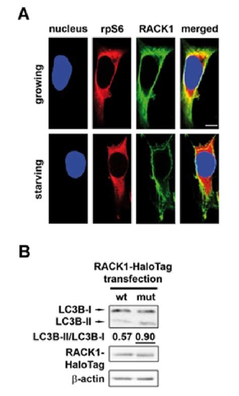 Growth Factor Nutrient Starvation In Human Cells Promotes Rack Release