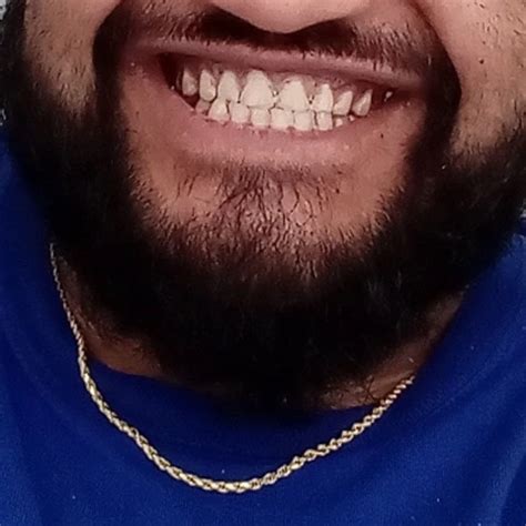 Handicap Gay Fetish Porn Feat Wheelie XHamster