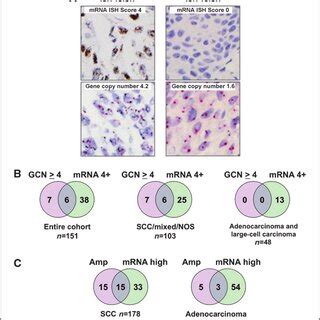 Association Of FGFR1 GCN Protein And MRNA Expression With Ponatinib