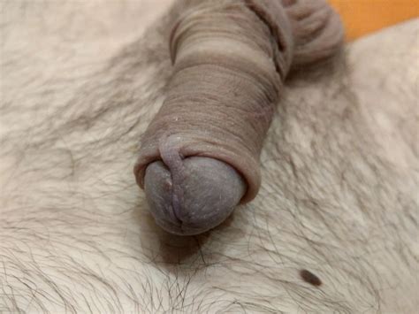 Limb Cock Banding Nude Pics XHamster