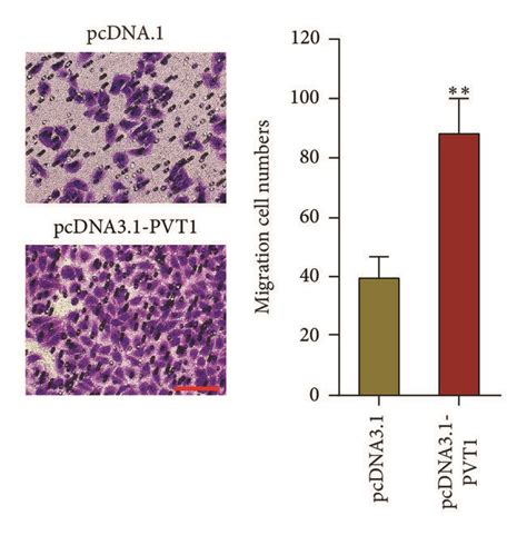 Overexpression Of Pvt Enhances Melanoma Cells Proliferation Cell