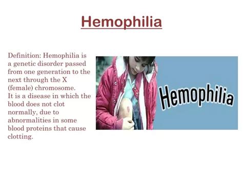 Ppt Hemophilia Powerpoint Presentation Free Download Id 2136951