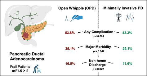 Minimally Invasive Pancreaticoduodenectomy A Favorable Approach For