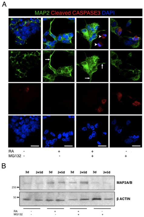 Effects Of The Combined Ra Mg Treatment On Neuronal Differentiation