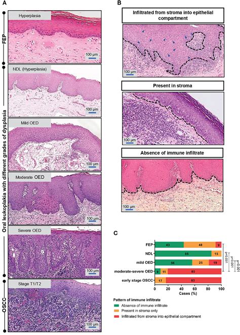 Frontiers Transcriptional Analysis Highlights Three Distinct Immune