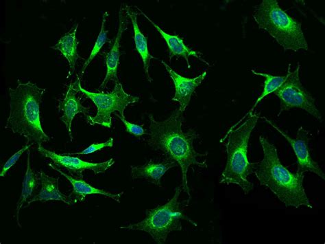 beta-2 Microglobulin Antibody (MA5-36022)