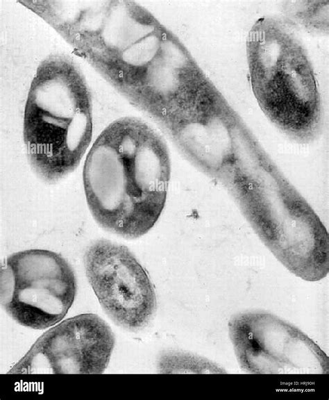 Anthrax Bacillus Anthracis Bacteria Tem Stock Photo Alamy