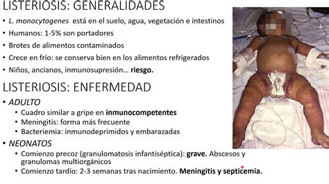 Microbiologia 12 Genero Listeria - YouTube