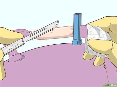 Cortar O Cordão Umbilical - 4 Formas de Cortar o Cordão Umbilical de um Bebê