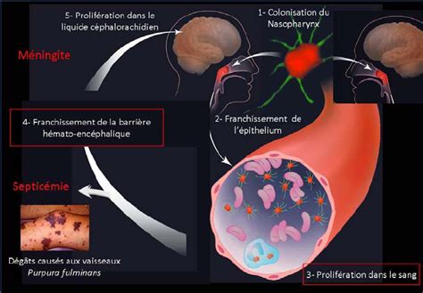 Le méningocoque envoie des éclaireurs pour se disséminer Salle de