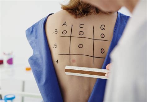 Intradermal Skin Testing - Allergy Asthma & Sinus Associates