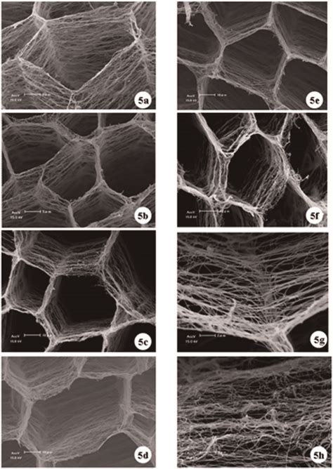 SEM photographs of endomysium. (a) BF-21d chicks. Bar indicates 5 mm ...