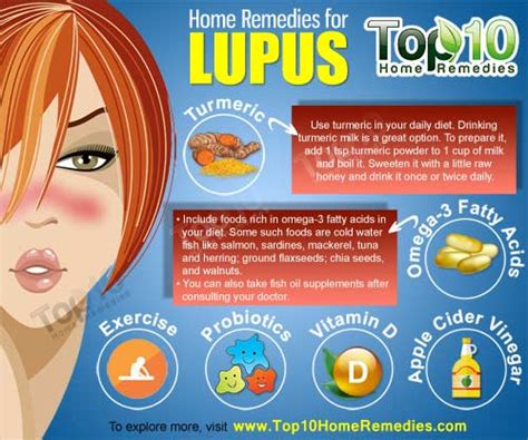 Home Remedies for Lupus | Top 10 Home Remedies