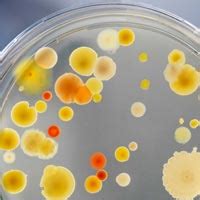 Microbiological Analysis Microbiological Analysis Providers In India