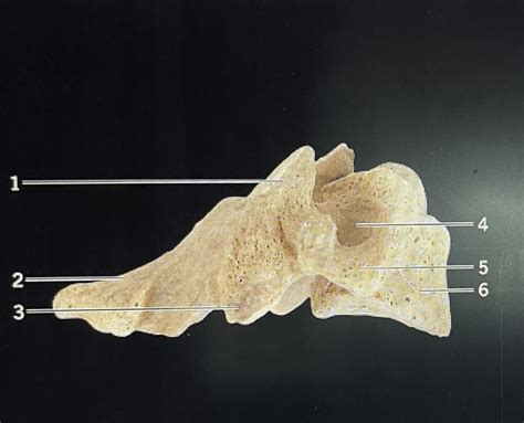 Cervical Vertebra Lateral View Diagram Quizlet