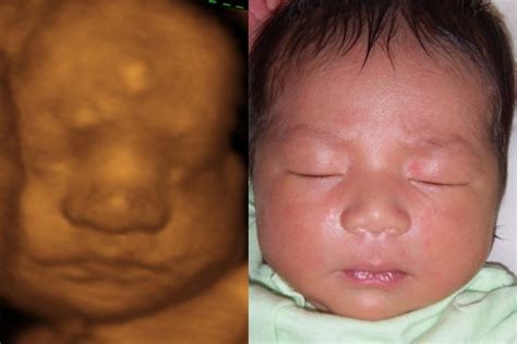 4 Patricia Marcos 3d 4d Hd Ultrasound Virginia