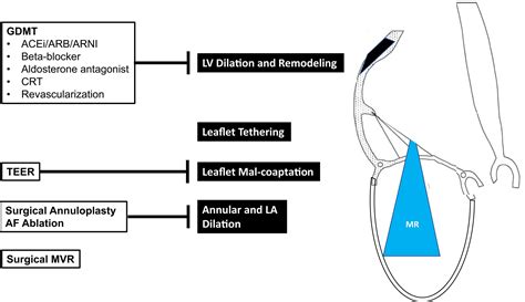 Secondary Mitral Regurgitation Cardiac Remodeling Diagnosis And