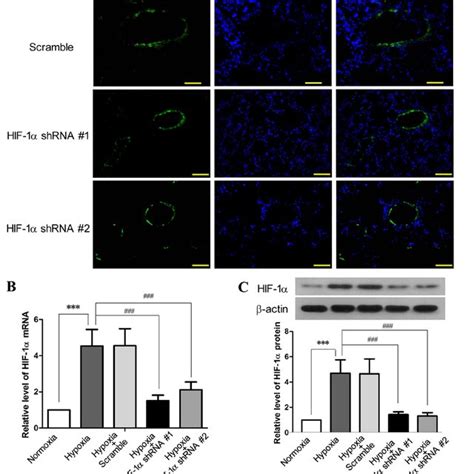 Hypoxia inducible factor 1α HIF 1α shRNA suppresses the Download