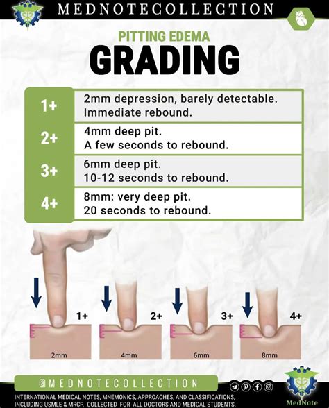 Pitting Edema Grading Of Pitting Edema Causes Of Pitting 50 OFF