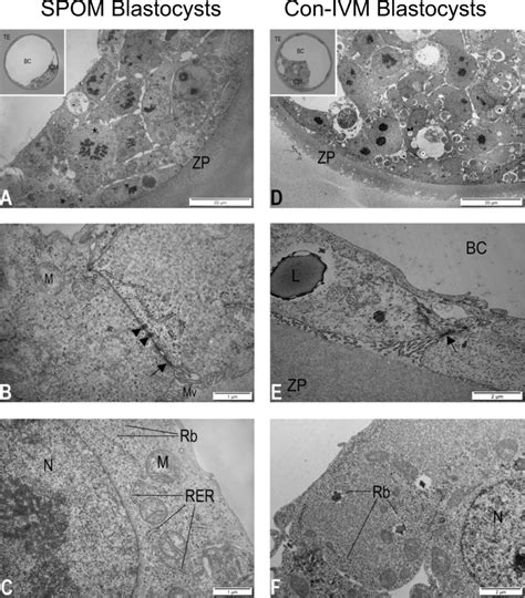 Transmission Electron Micrographs Of Bovine Blastocysts Produced After