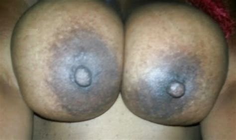 Big Black Areolas Massive Collection Part 24 Porn Pictures XXX Photos Sex Images