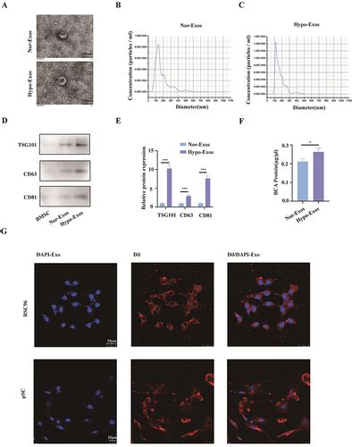 Full Article Hypoxic Bone Mesenchymal Stem Cell Derived Exosomes