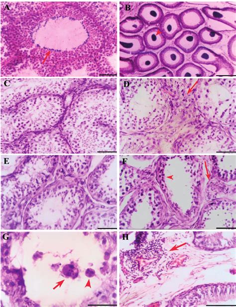 Photomicrograph Of Testis And Epididymis Stained With Hematoxylin And