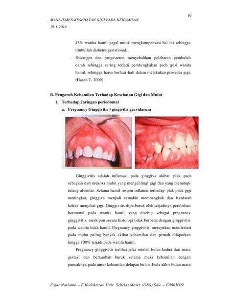 Anatomi Dan Fisiologi Gigi Dan Mulut Pdf Masafbi