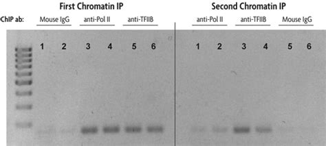 Re ChIP IT Chromatin Immunoprecipitation Chromatin IP Kit For