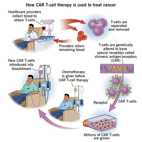 Car T Cell Therapy