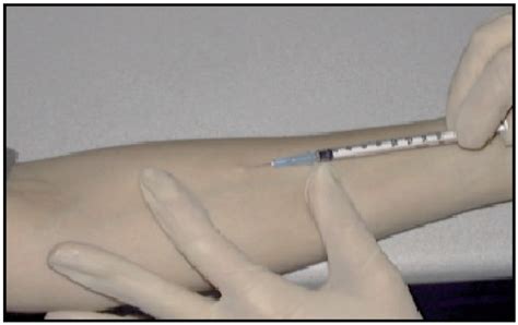 Administering Reading And Interpreting A Tuberculin Skin Test