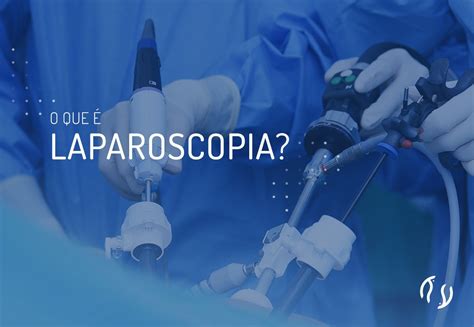 O que é laparoscopia Dr Luiz Flávio