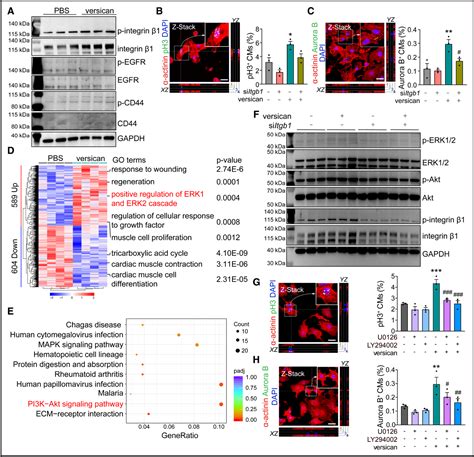 Figure 5 From Versican Promotes Cardiomyocyte Proliferation And Cardiac