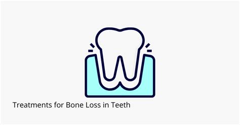 Treatments For Bone Loss In Teeth Share Dental Care