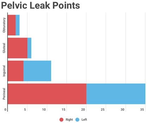 A Comprehensive Ultrasound Approach To Lower Limb Varicose Veins And