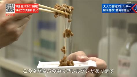 大人の食物アレルギー “意外な原因と組み合わせ” 対策は Nhk クローズアップ現代 全記録