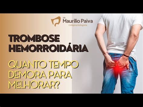 Trombose Hemorroid Ria Quanto Tempo Demora Para Melhorar Youtube